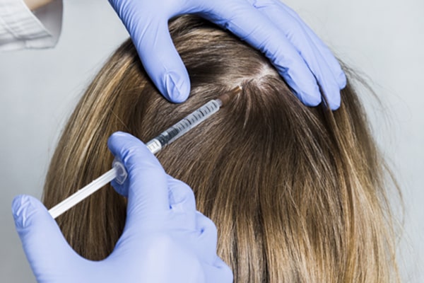 روش مزوتراپی مو چگونه عمل می کند؟