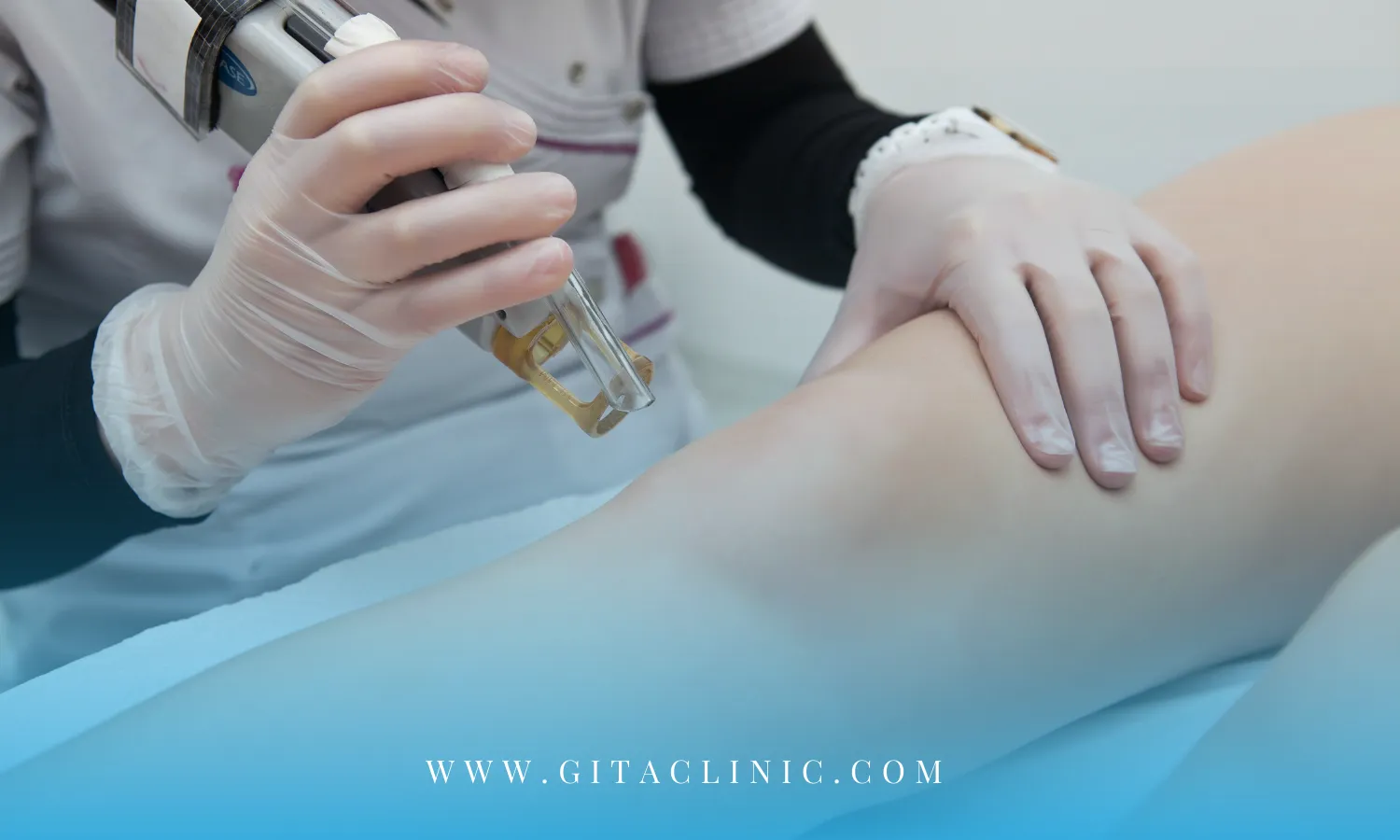 آیا لیزر موهای زائد دائمی است؟