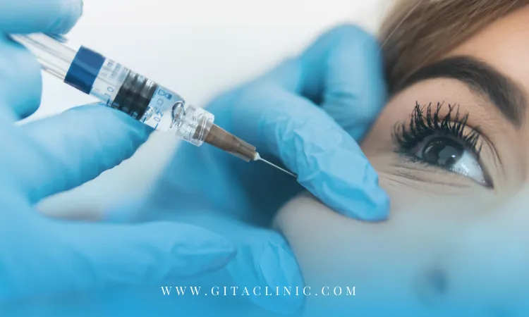 رفع گودی و تیرگی زیر چشم