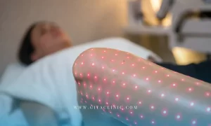 آیا لیزر مو زائد باعث سرطان یا نازایی می‌شود؟