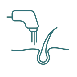 لیزرموهای زائد