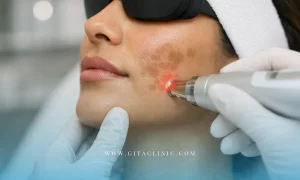 درمان قطعی لک ملاسما